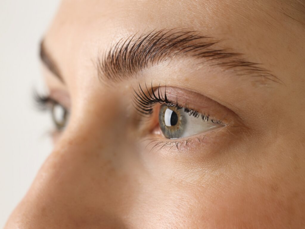 Before and after blepharoplasty in London showing eyelid transformation
