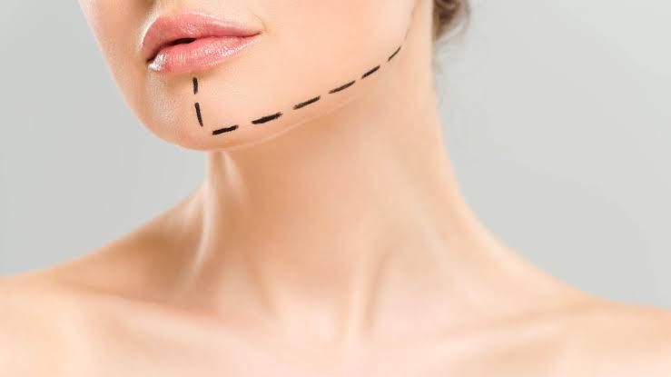 Chin Augmentation in London